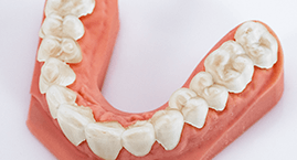 occlusal_splints occlusal_splints